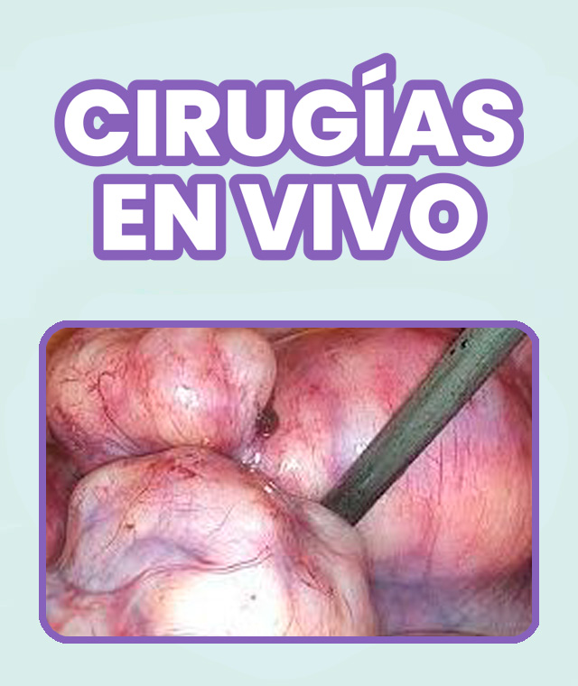 II Curso Internacional de Laparoscopía Ginecológica